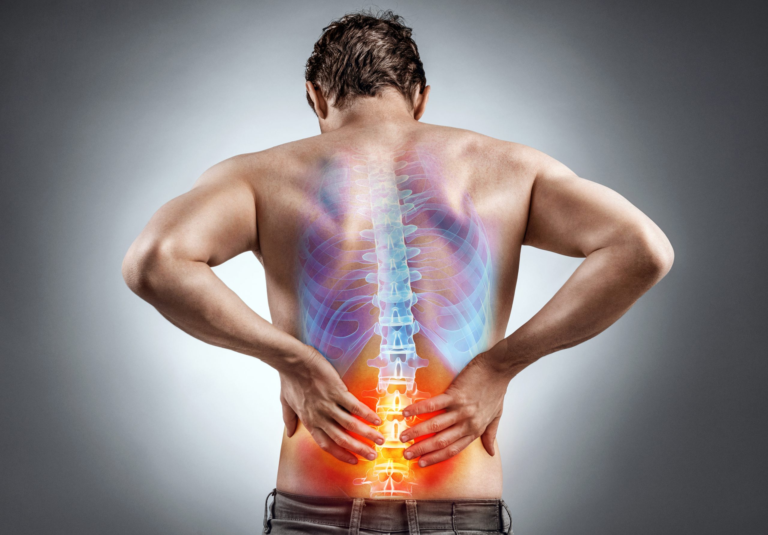 Chronic Back Pain Due to Herniated Disc